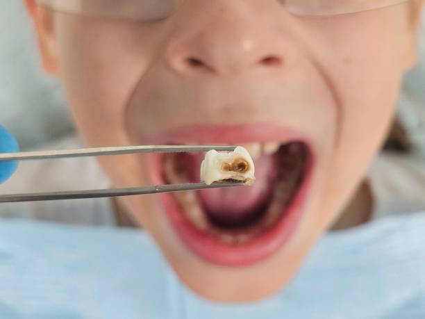 Best Emergency Denture Repair in Vla Park, IL